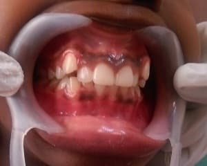 Orthodontics & Braces